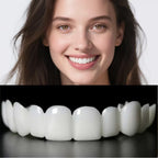 Facetas Dentárias Removíveis SorrisoFlex