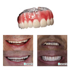 Dentadura de Silicone FIX | Ajustavel e Adaptativa